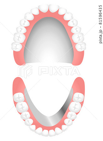 入れ歯（金属床） 81596435