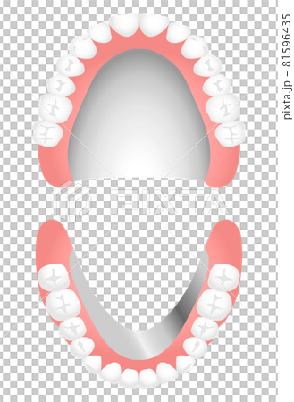 Dentures (metal floor) 81596435