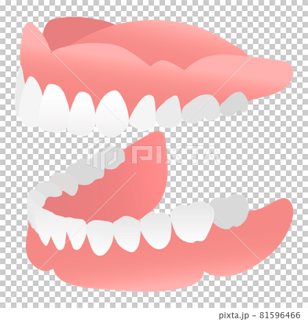 Side of dentures (dentures) 81596466