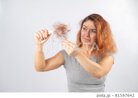 Caucasian woman with a grimace of horror holds a comb with a bun of hair. Hair loss and female alopecia. Caucasian woman with a grimace of horror holds a comb with a bun of hair. Hair loss and female alopecia. 81597642