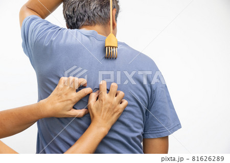 Senior man and his wife scratching his back Senior man and his wife scratching his back 81626289