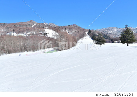 発哺ブナ平スキー場(長野県山ノ内町)【2021.3】 81631253