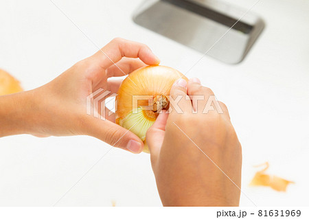 玉ねぎの皮むき 81631969