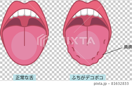 舌のイラストのイラスト素材