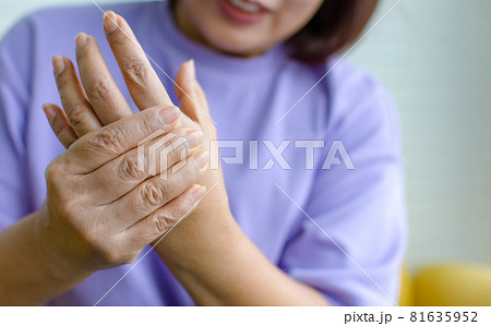 Woman using hand to hold other her palm with feeling pain, hurt and tingling. Concept of Guillain barre syndrome and numb hands disease. 81635952