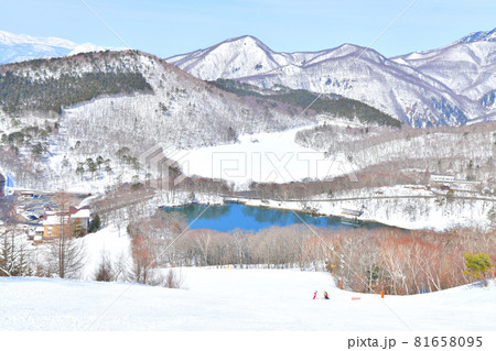 志賀高原 サンバレースキー場より丸池、琵琶池方面を望む(長野県山ノ内町)【2021.3】 81658095