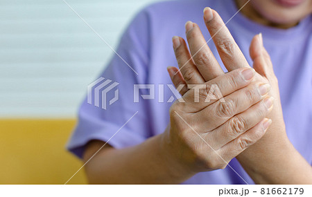 Woman using hand to hold other her palm with feeling pain, hurt and tingling. Concept of Guillain barre syndrome and numb hands disease. Woman using hand to hold other her palm with feeling pain, hurt and tingling. Concept of Guillain barre syndrome and numb hands disease. 81662179