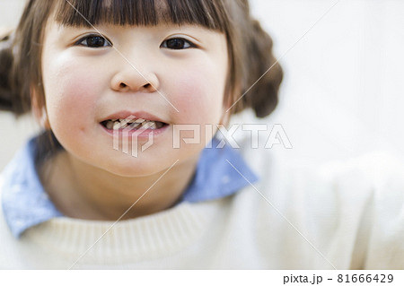 乳歯が抜けた女の子 乳歯が抜けた女の子 81666429