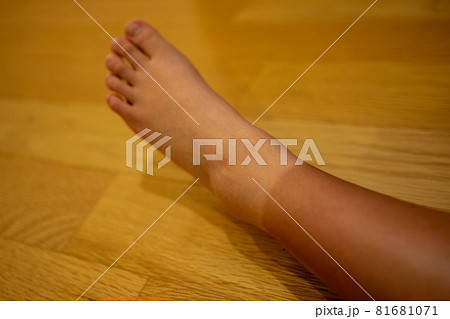 靴下焼け 81681071