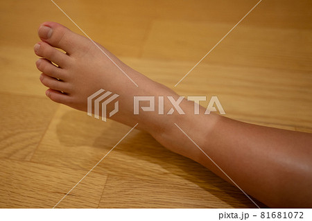 靴下焼け 81681072