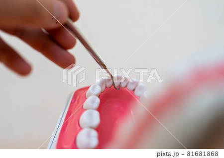 スケーラー スケーラー 81681868