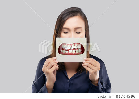 Asian women having poor oral health Asian women having poor oral health 81704596