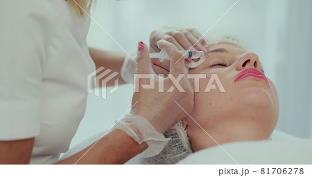 Closeup of beautician hands doing facial skin lifting injection to young woman face. Beautiful female patient receiving beauty procedure. Cosmetic treatment. Closeup of beautician hands doing facial skin lifting injection to young woman face. Beautiful female patient receiving beauty procedure. Cosmetic treatment. 81706278