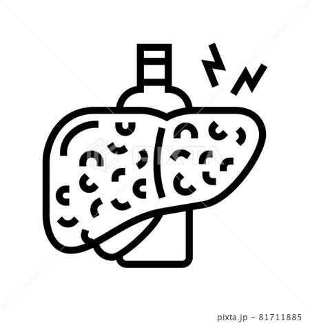 cirrhosis hepatitis line icon vector illustration 81711885