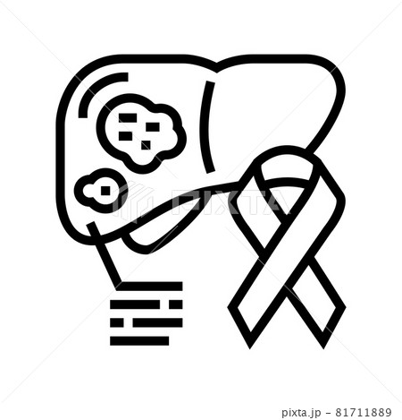 liver cancer line icon vector illustration 81711889