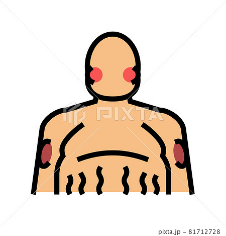cushing disease endocrinology color icon vector illustration 81712728