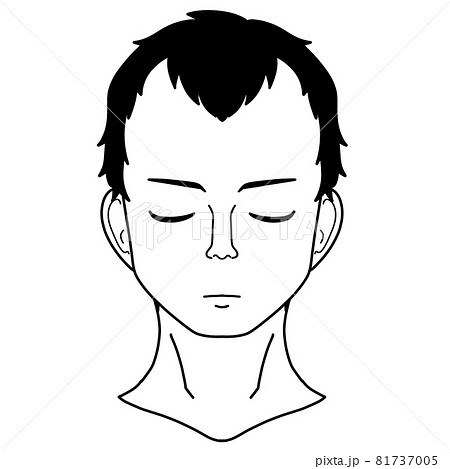 おでこが広い薄毛男性の正面白黒イラスト 81737005
