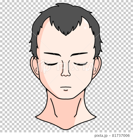おでこが広い薄毛男性の正面イラスト 81737006
