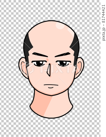 てっぺんハゲ頭の男性　正面　イラスト 81744421