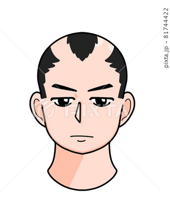 生え際が薄毛の男性 正面 イラストのイラスト素材