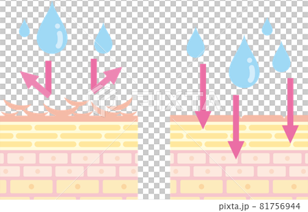 ノーマル肌とトラブル肌の断面図。化粧水は角質のたまった皮膚には浸透しない。 81756944