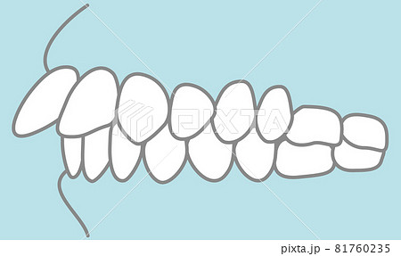 噛み合わせのイラスト 81760235