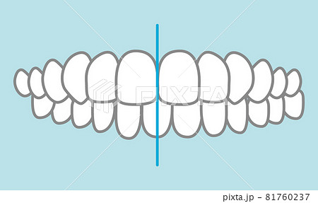 噛み合わせのイラスト 81760237