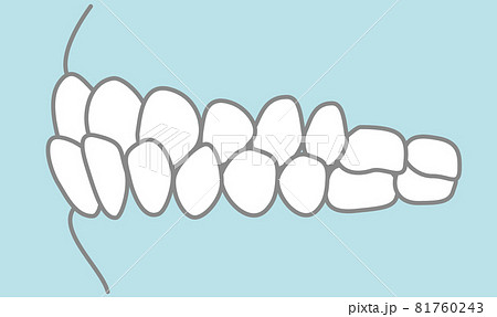 噛み合わせのイラスト 81760243