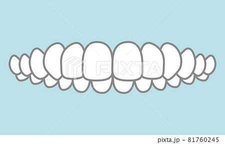 噛み合わせのイラスト 噛み合わせのイラスト 81760245