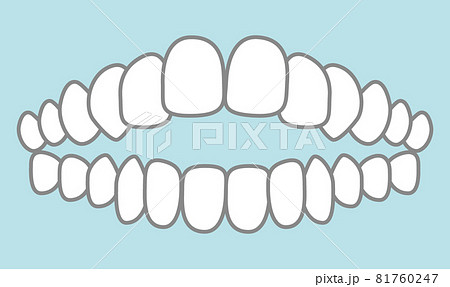 噛み合わせのイラスト 81760247