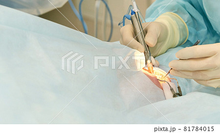 Ophthalmology laser microscope operation. Doctor in clinic. Patient eye treatment. Myopia and cataract removal 81784015