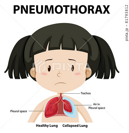 BR_gf_medical_2021-25.eps BR_gf_medical_2021-25.eps 81793812