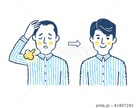 薄毛の進行と増毛のイメージ ビフォーアフターのイラスト素材