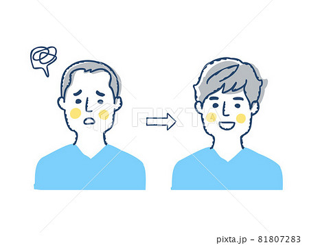 薄毛の進行と増毛のイメージ　ビフォーアフター 81807283