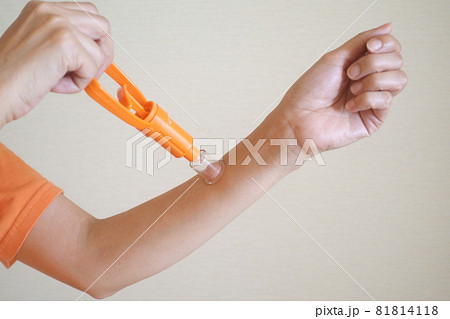 ポイズンリムーバー　虫刺され毒の吸出し 81814118