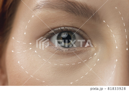 Close-up portrait of young, beautiful and healthy woman with arrows on her eye, face. The spa, surgery, face lifting and skin care concept Close-up portrait of young, beautiful and healthy woman with arrows on her eye, face. The spa, surgery, face lifting and skin care concept 81833928