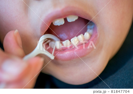 7 years old 81847704