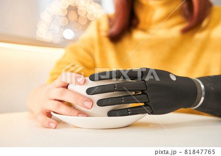Woman with artificial limb drinking hot tea at the cafeteria 81847765