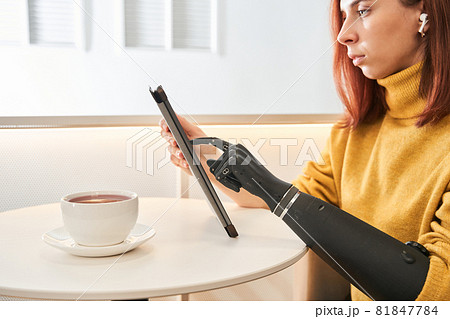 Woman with prosthesis arm reading book on digital tablet 81847784