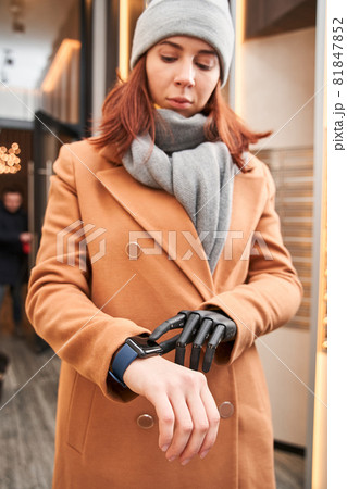 Female with prosthesis arm tracking time on smartwatch Female with prosthesis arm tracking time on smartwatch 81847852