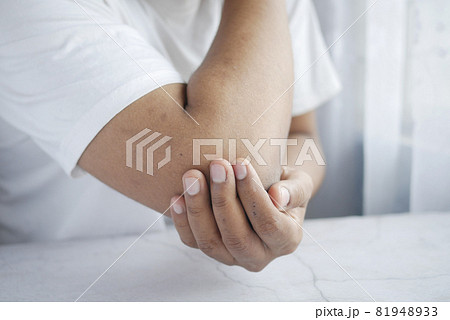 man with elbow pain, Pain relief concept. 81948933