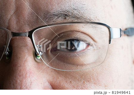 眼鏡をかけた中年男性の目のアップ 81949641