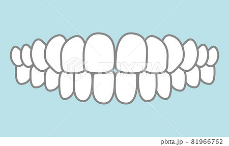正しい歯並びのイラスト 正しい歯並びのイラスト 81966762