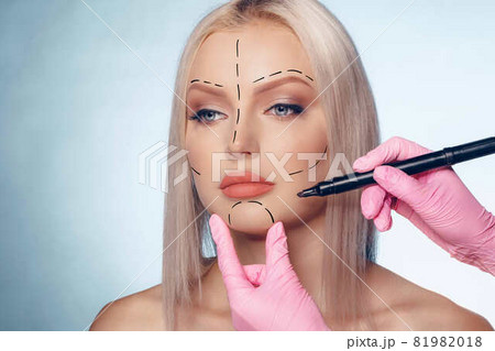 Beautiful blonde woman with markings for plastic surgery on her face Beautiful blonde woman with markings for plastic surgery on her face 81982018