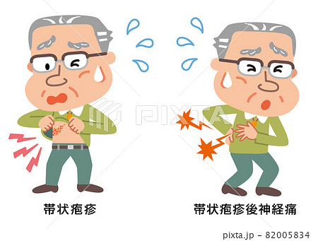 帯状疱疹と帯状疱疹後神経痛の高齢者男性のイラスト 帯状疱疹と帯状疱疹後神経痛の高齢者男性のイラスト 82005834