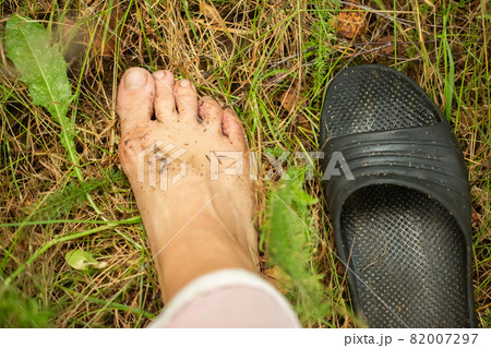 the foot is covered with mud on the grass 82007297