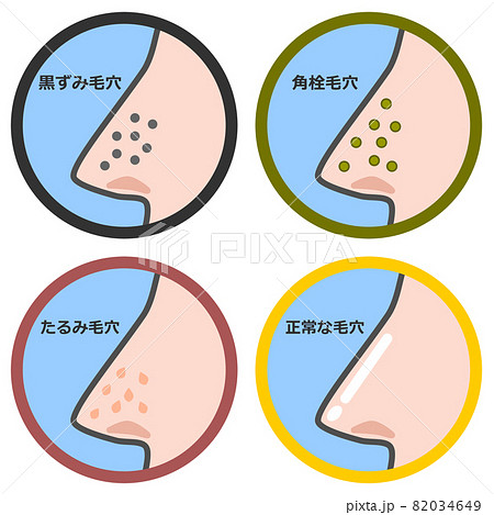 鼻の毛穴の状態を表すパターンのイラスト 82034649