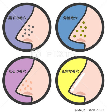鼻の毛穴の状態を表すパターンのイラスト 82034653