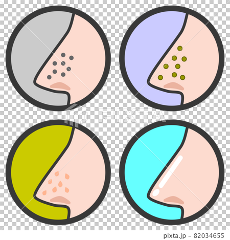 鼻の毛穴の状態を表すパターンのイラスト 82034655
