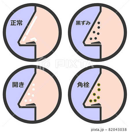 鼻の毛穴の状態を表すイラスト 82043038